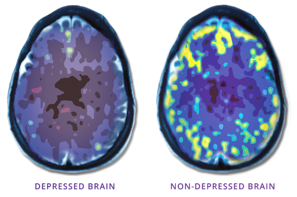 Mark-George-BrainScan-600x398